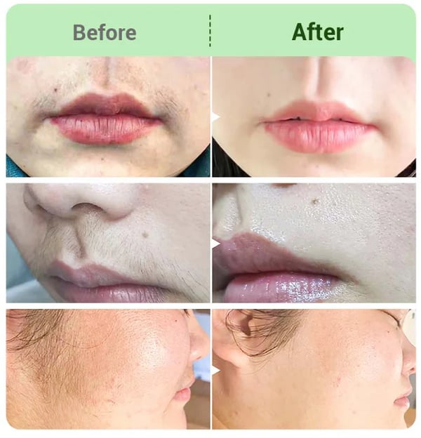🔥Hair Removal Cream Kit for Women - 1 Set (Hair Remover + Repair)