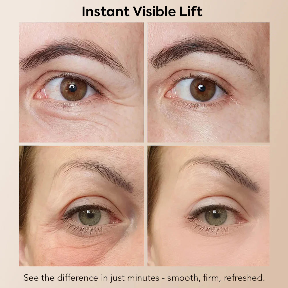 🏆Instant Eye Tightener Easy-Wear Formula – Ultimate Lift & Smooth Finish ✨✨