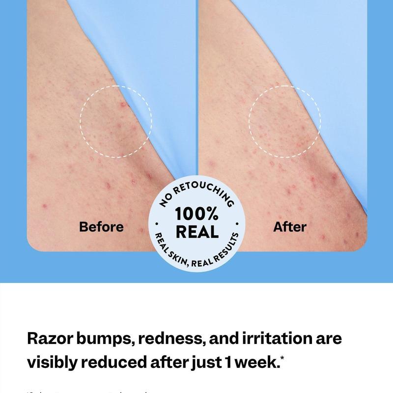 Women's Smoothing Serum For Ingrown Hairs, Razor Bumps And Redness