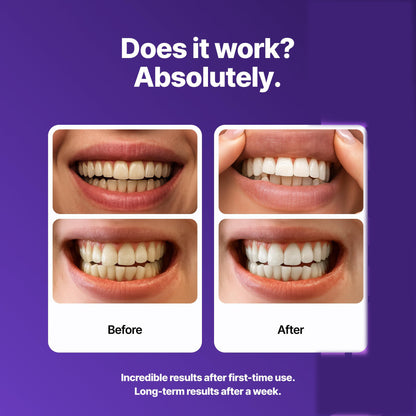 PURPLE WHITENING STRIPS