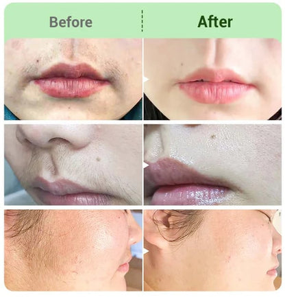 🔥Hair Removal Cream Kit for Women - 1 Set (Hair Remover + Repair)