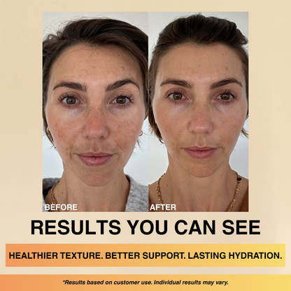 Brightening, Anti-Aging & Whitening Cream