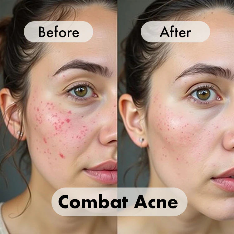 Red Light Therapy Facial Mask (+7 Beneficial Colors)