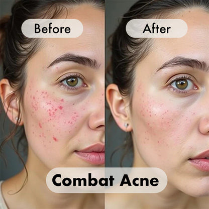 Red Light Therapy Facial Mask (+7 Beneficial Colors)