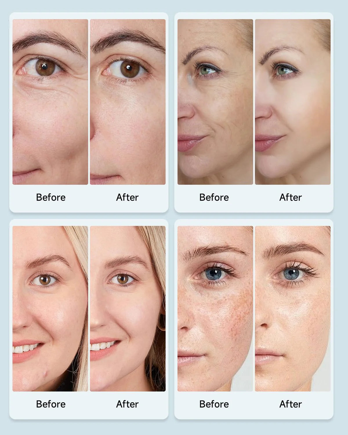 Red Light Therapy Facial Mask (+7 Beneficial Colors)