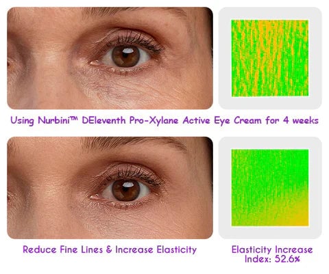 👀 Pro-Xylane Active Eye Cream🤩😍💃🏼