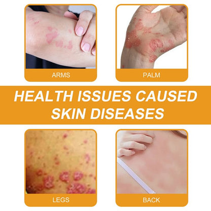 💥Bee Venom Multi-Symptom Skin Cream (👨‍⚕CDA RECOMMENDS)