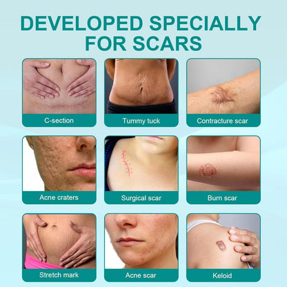 Advanced Scar Spray For All Types of Scars - For example Acne Scars, Surgical Scars and Stretch Marks
