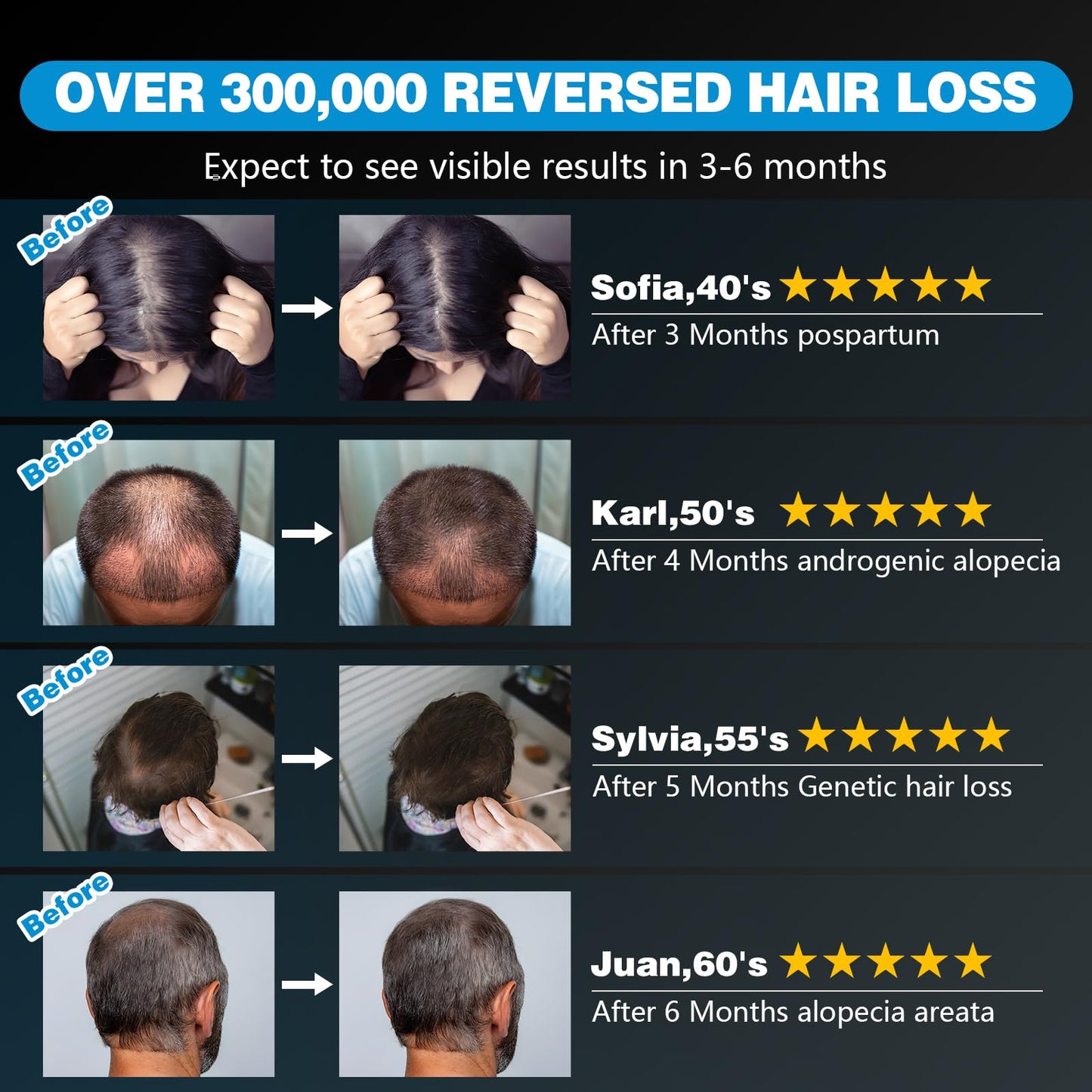 Red Light Therapy Hair Growth Cap