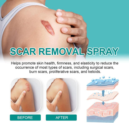 Advanced Scar Spray For All Types of Scars - For example Acne Scars, Surgical Scars and Stretch Marks