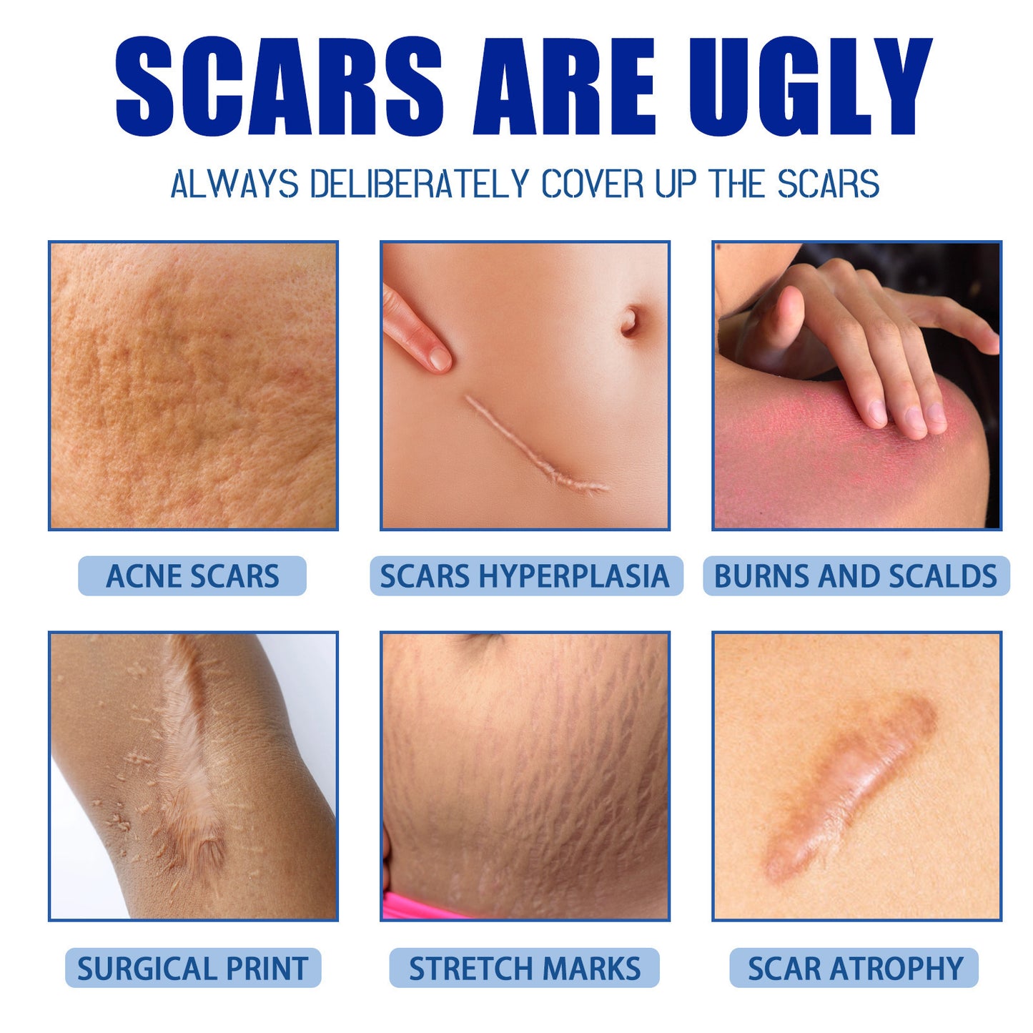 Smooth Skin Anti-Scar Repair Cream