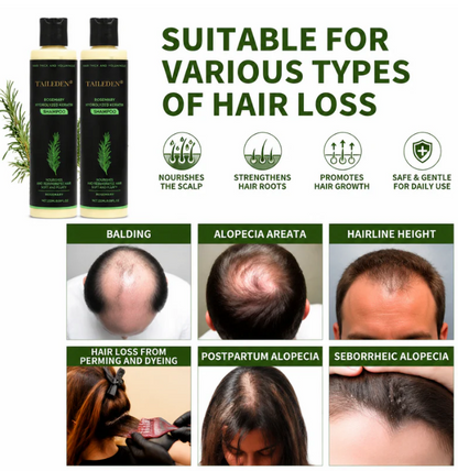 Organic Rosemary Hair Growth Shampoo