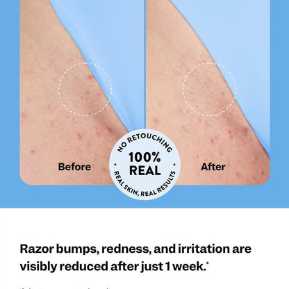 Women's Smoothing Serum For Ingrown Hairs, Razor Bumps And Redness